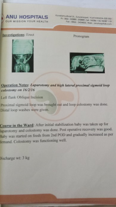 Colostomy operation(no asshole by birth) Details