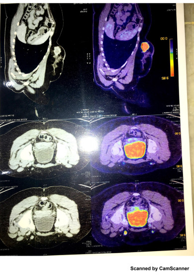 Scan