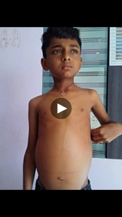 Mithilesh before surgery