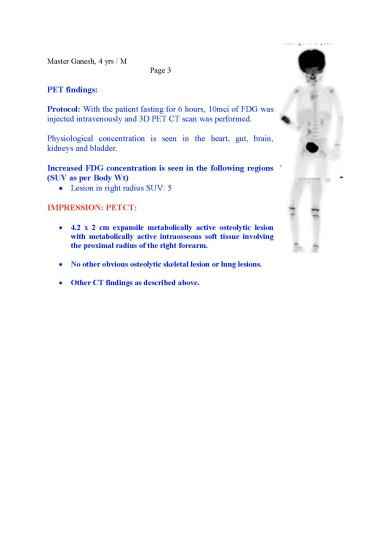 PET DOCUMENT POST CHEMOTHERAPY