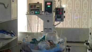 video of Babies showing huge abdominal distension