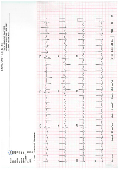 Tanaya's Treatment Updated Document (4/18)