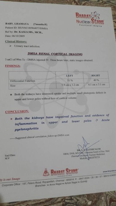 DMSA Renal cortical imaging