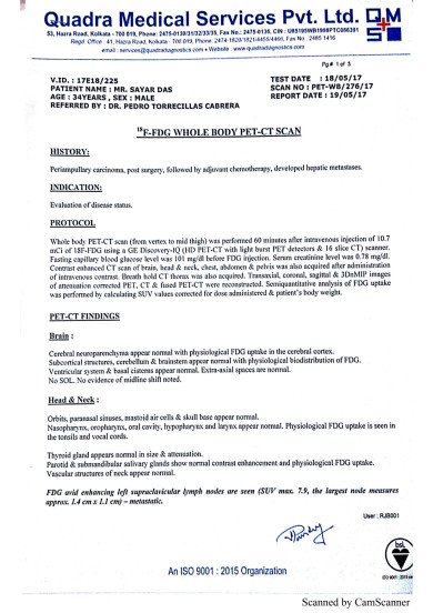 PET CT REPORT 18/05/2017