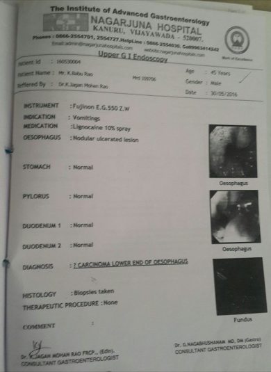 Biopsy