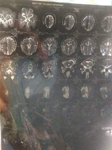 Head CT scan