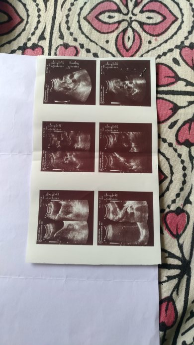 ultrasound report