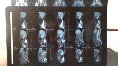 CT Scan