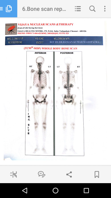 Bone test
