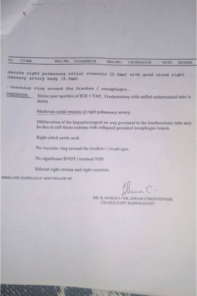 Heart Surgery document