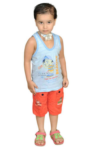 Photo of patient S. Jathin Raj