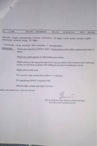 Status post operative of ICR+TAP, Trachestomy with cuffed endotrachea