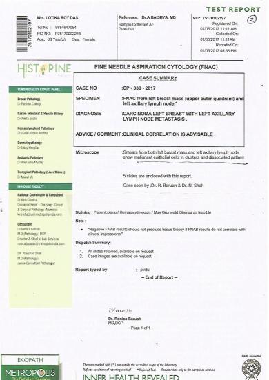 FNAC FROM LEFT BREAST MASS