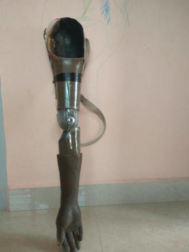 Pic of broken artificial hand near the shoulder