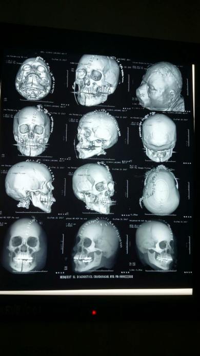 Xray
