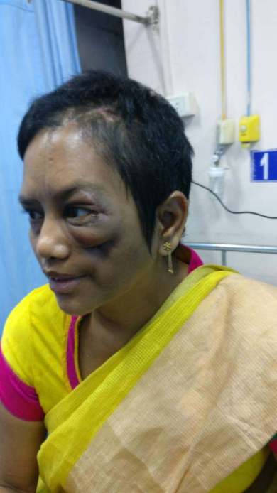 After Surgery