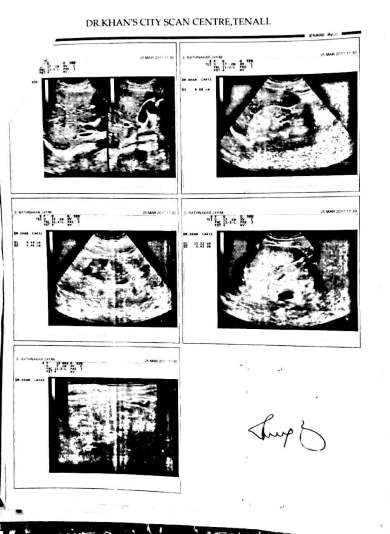 scans