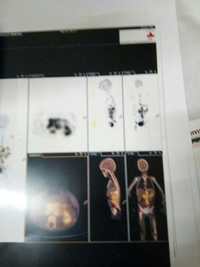 Scan Image