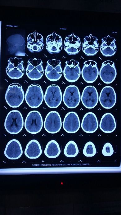 CTA BRAIN -2