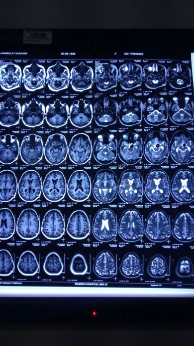 MRI Brain -3