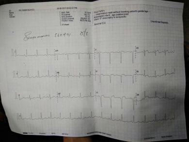 ECG report