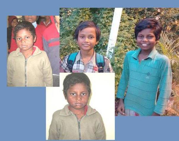 Children successfully rehabilitated