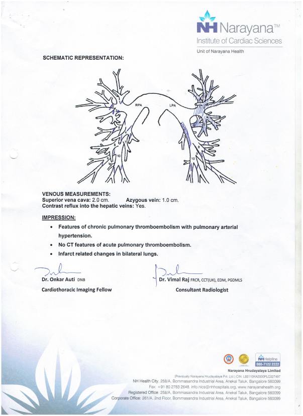 Schematic Representation