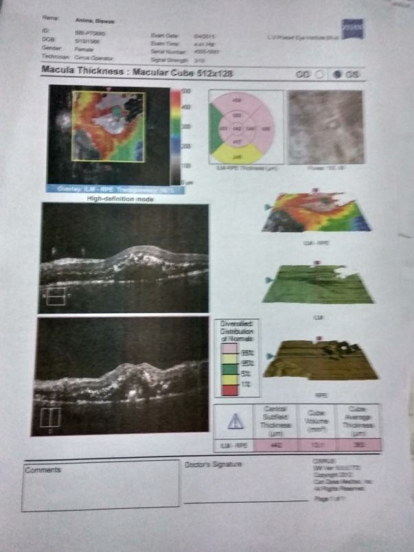 Eye test medical report