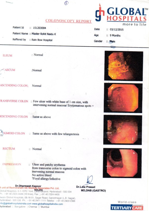 Colonoscopy Report