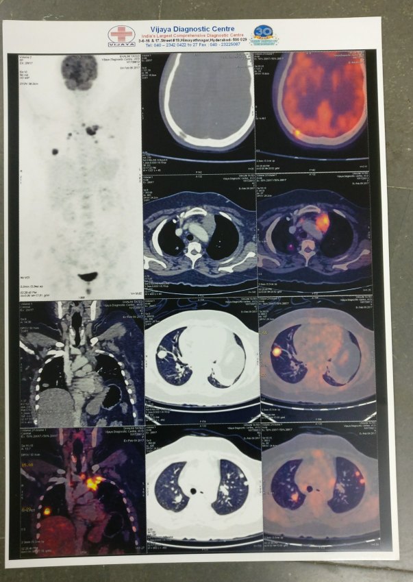 PET SCAN FILM