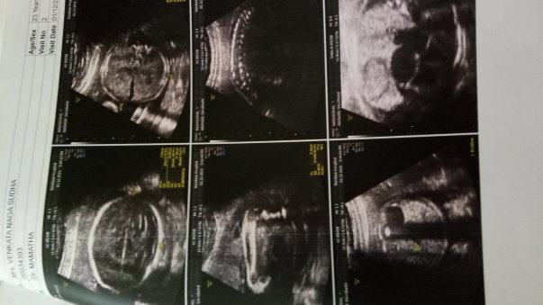 ULTRASONOGRAPHY AT THE AGE 1MONTH