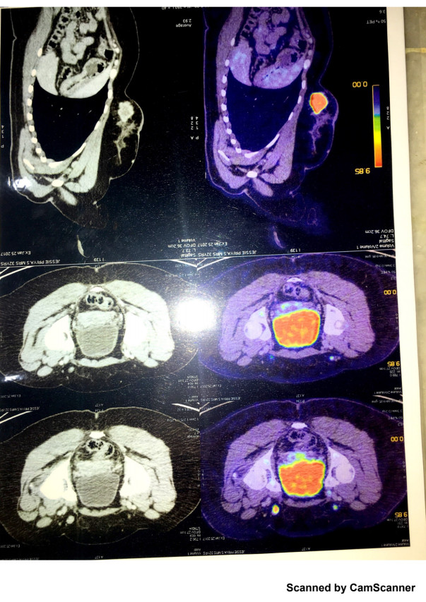 Scan