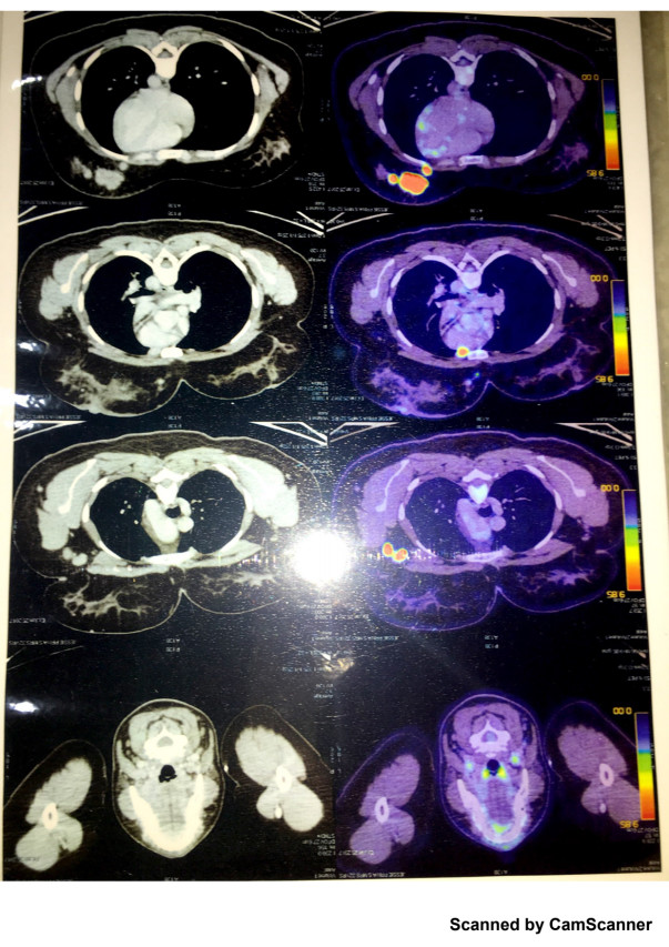 Scan 2