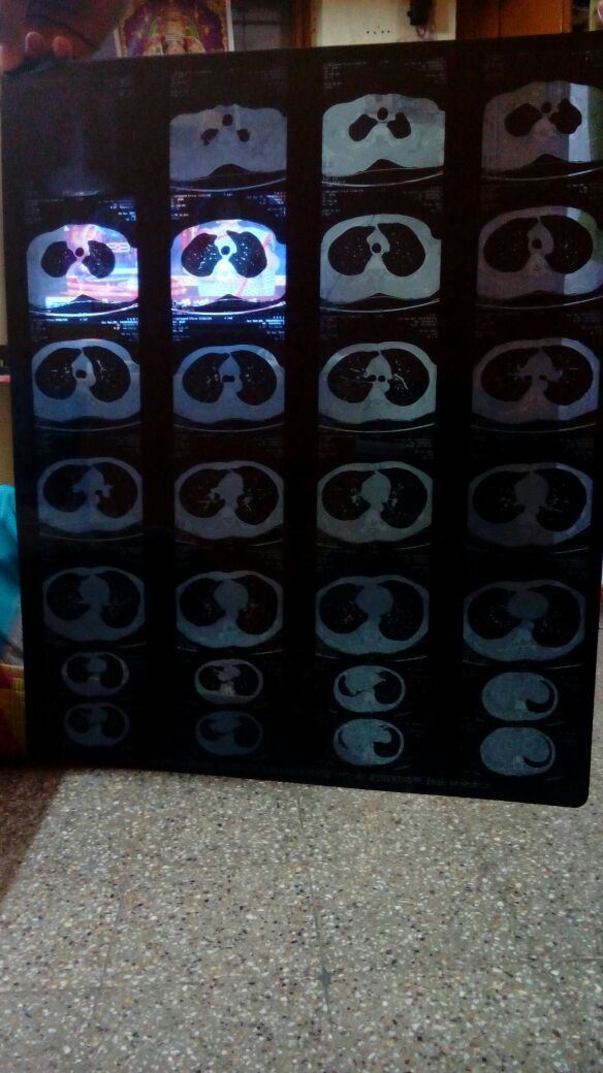 1 MRI Scan Report