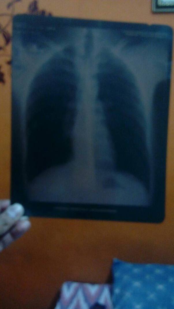 More MRI Scan Report
