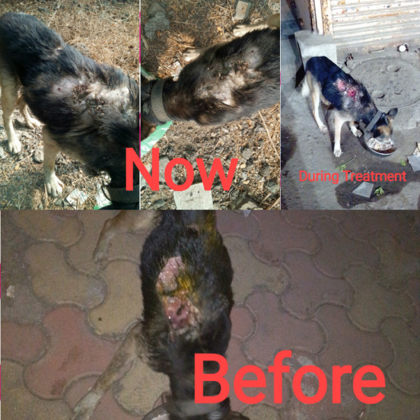 Burns wound turned to Maggots wound case completely healed