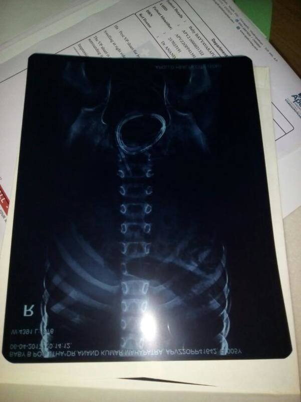 xray