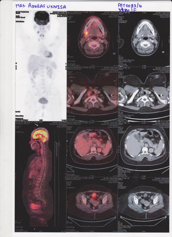 Pet Scan Report