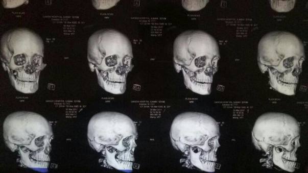 Diagnosis1