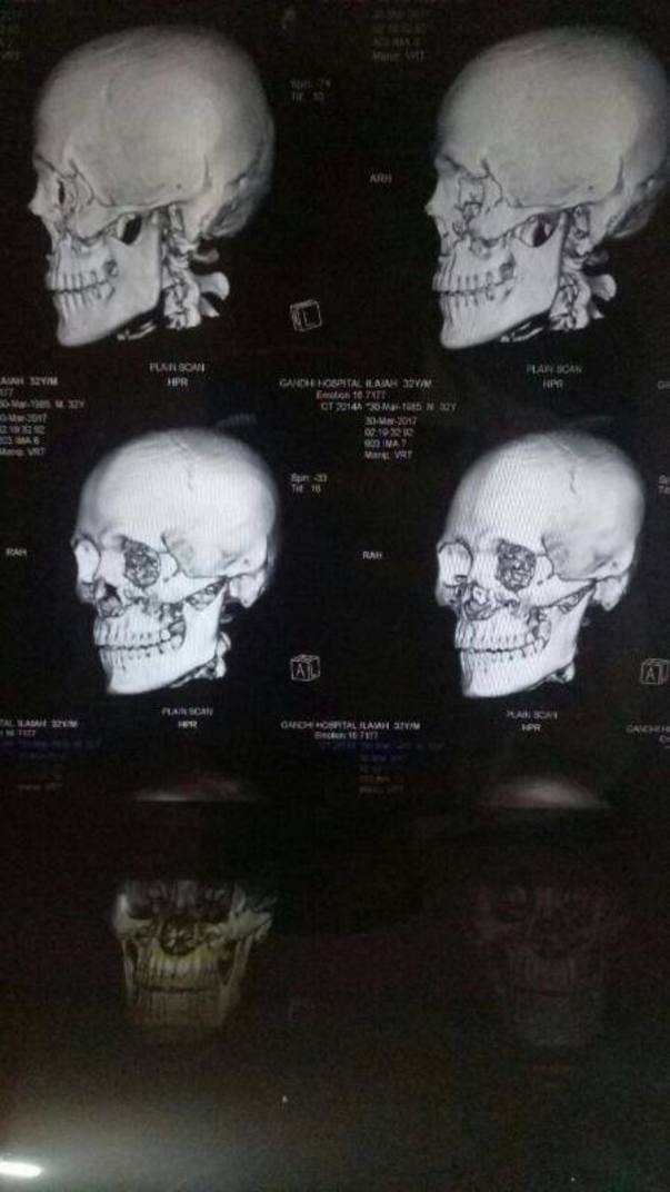 Diagnosis2