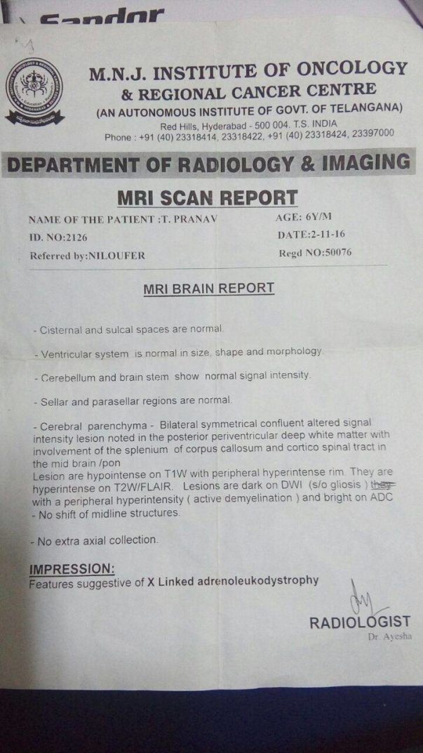 MRI Scan