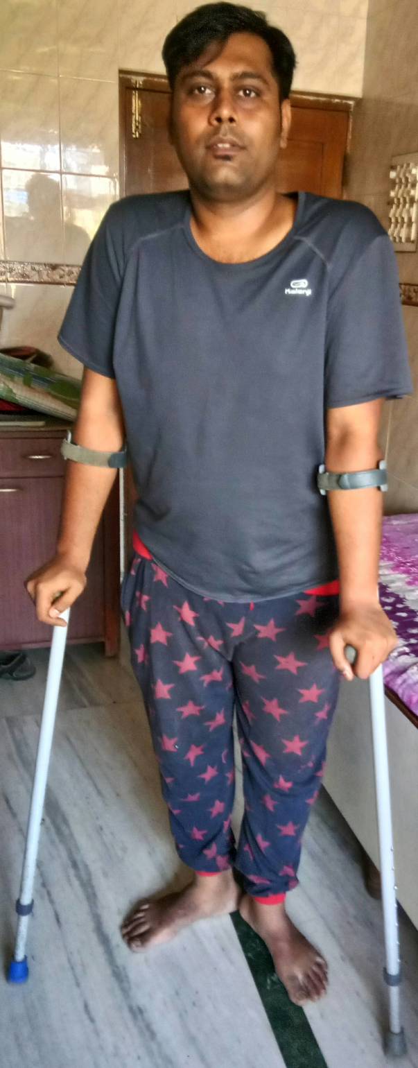 partially disabled gait