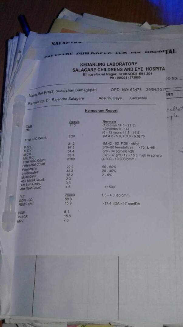 Blood report Showing severe thrombocytopenia (decreased platilets)