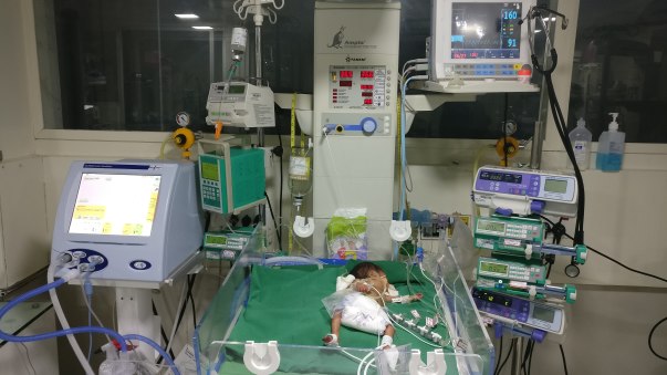 On respiratory support