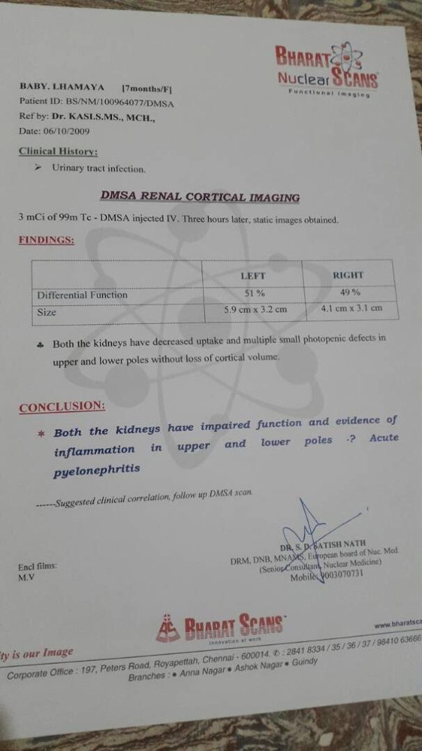 DMSA Renal cortical imaging