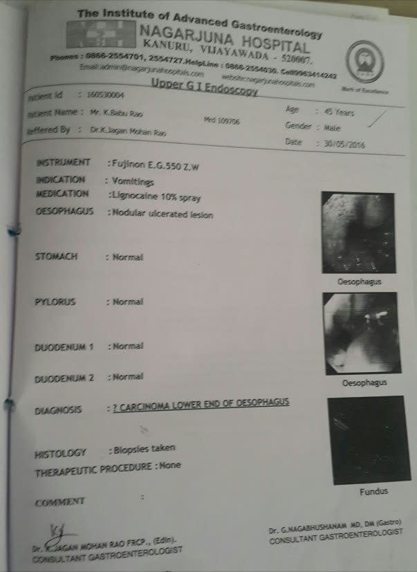 Biopsy