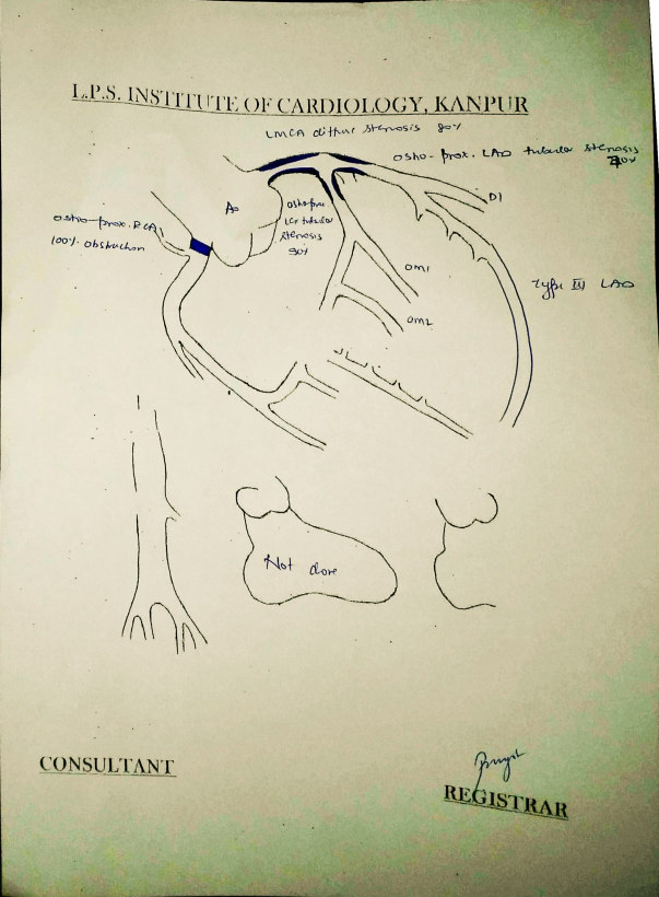 Image of the heart generated in angiography report