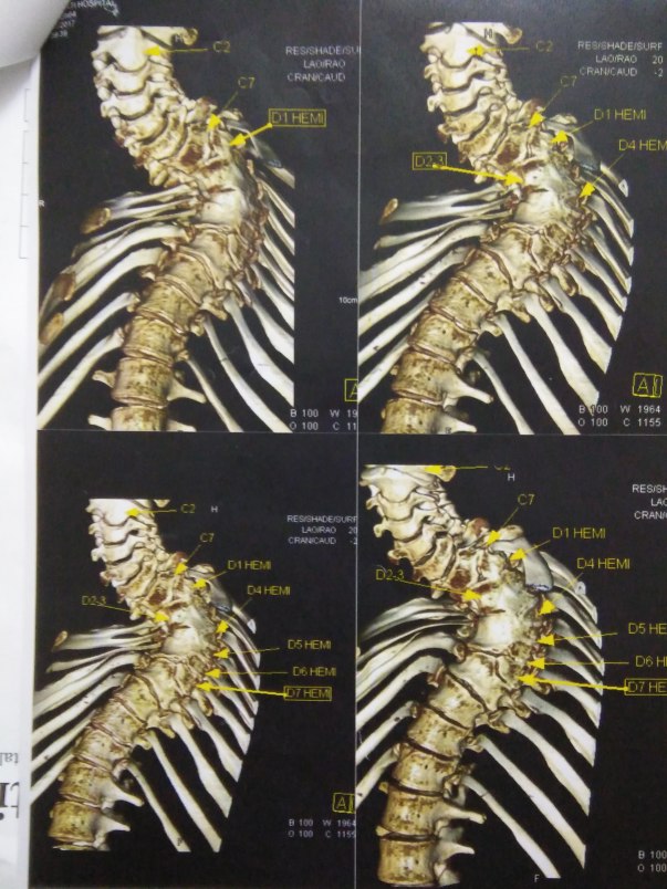 CT scan reports