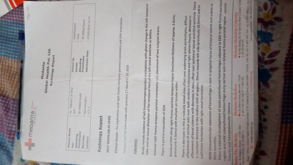 Radiology report (brain ct scan) before surgery