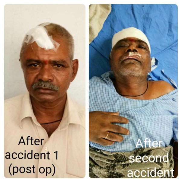 Picture after accident 1(after op) and after accident 2